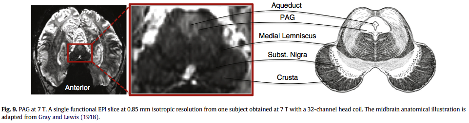 Dlpag Brainstem Wiki