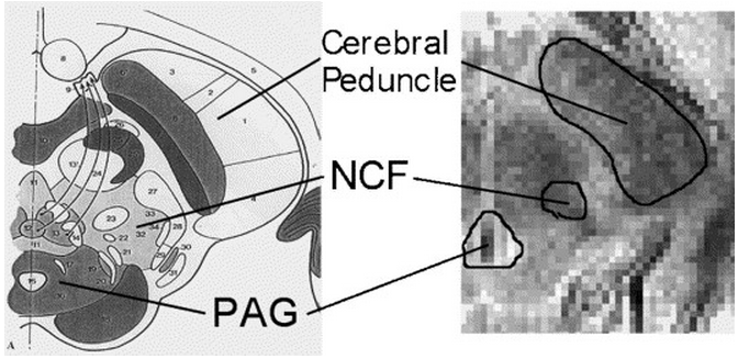  NCF and PAG