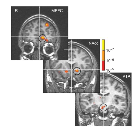 fig_vta_coronal.png