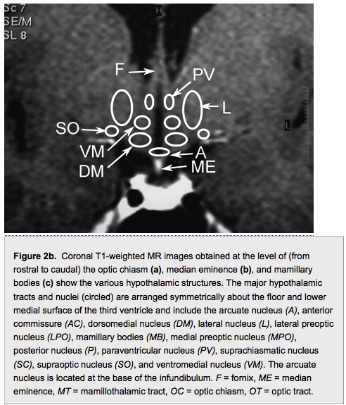 hypothalamus2.png