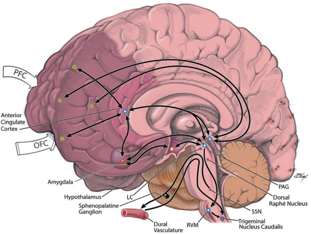 maizels2012neurolimbicmodelofmigraine.headache..png