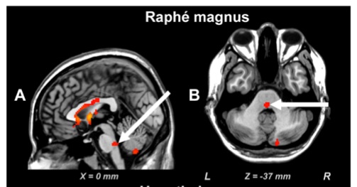 raphe_magnus_woo_2009.jpg