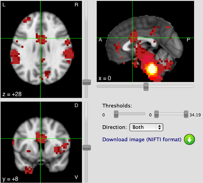 rvm_neurosynth_connectivity_0_-36_-40.png